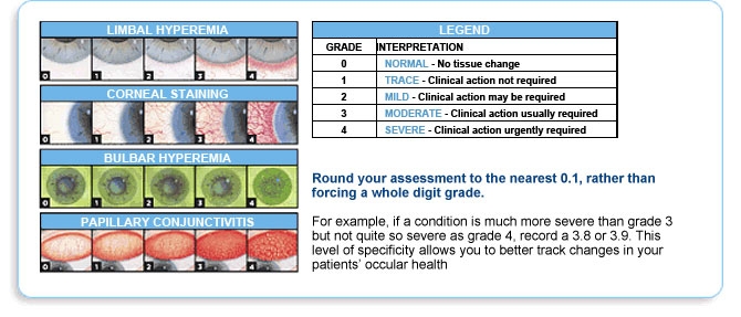 Grading scales Grading scales